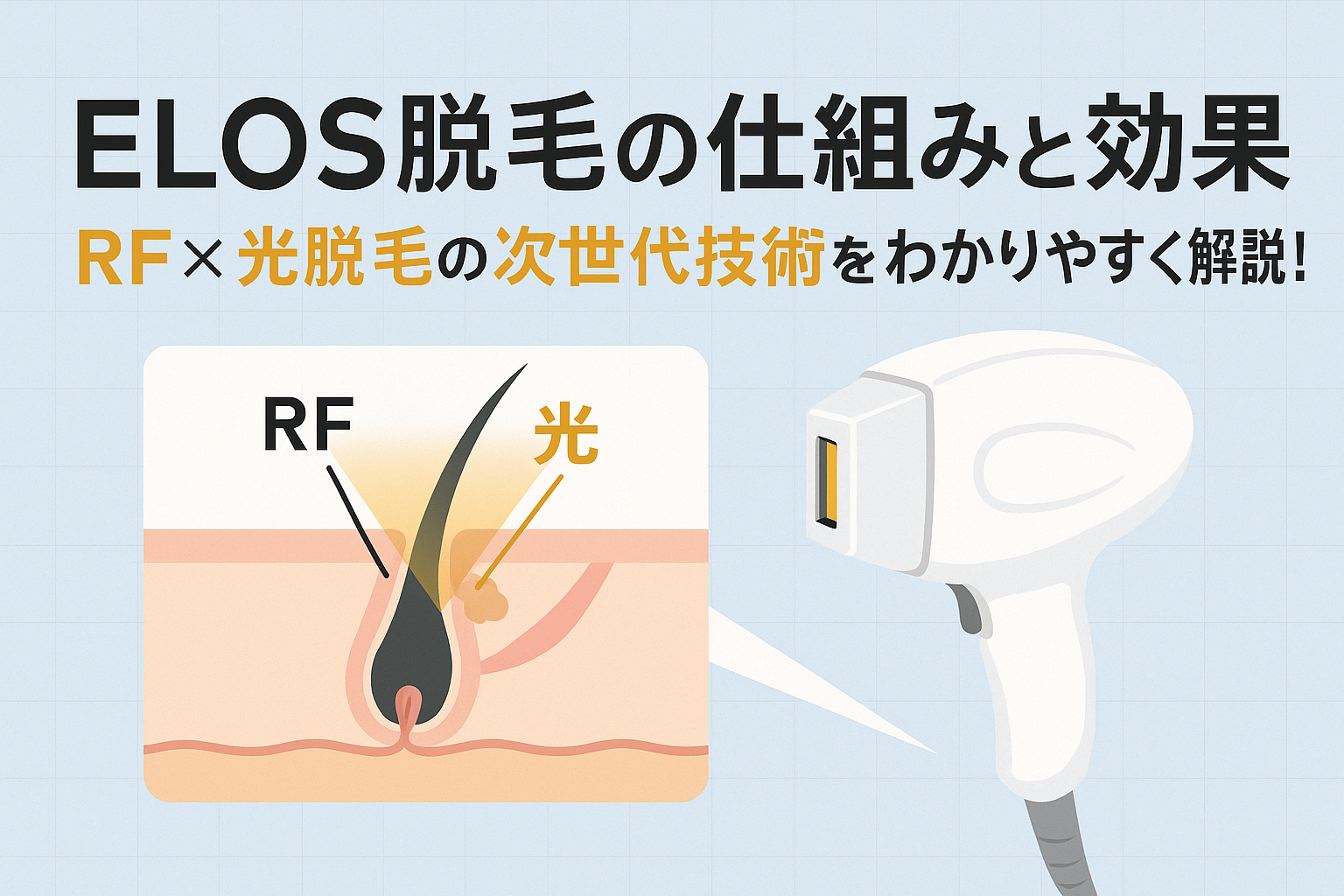 ELOS脱毛の仕組みと効果｜RF×光脱毛の次世代技術をわかりやすく解説！