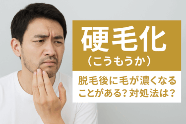 硬毛化（こうもうか） | 脱毛後に毛が濃くなることがある？対処法は？