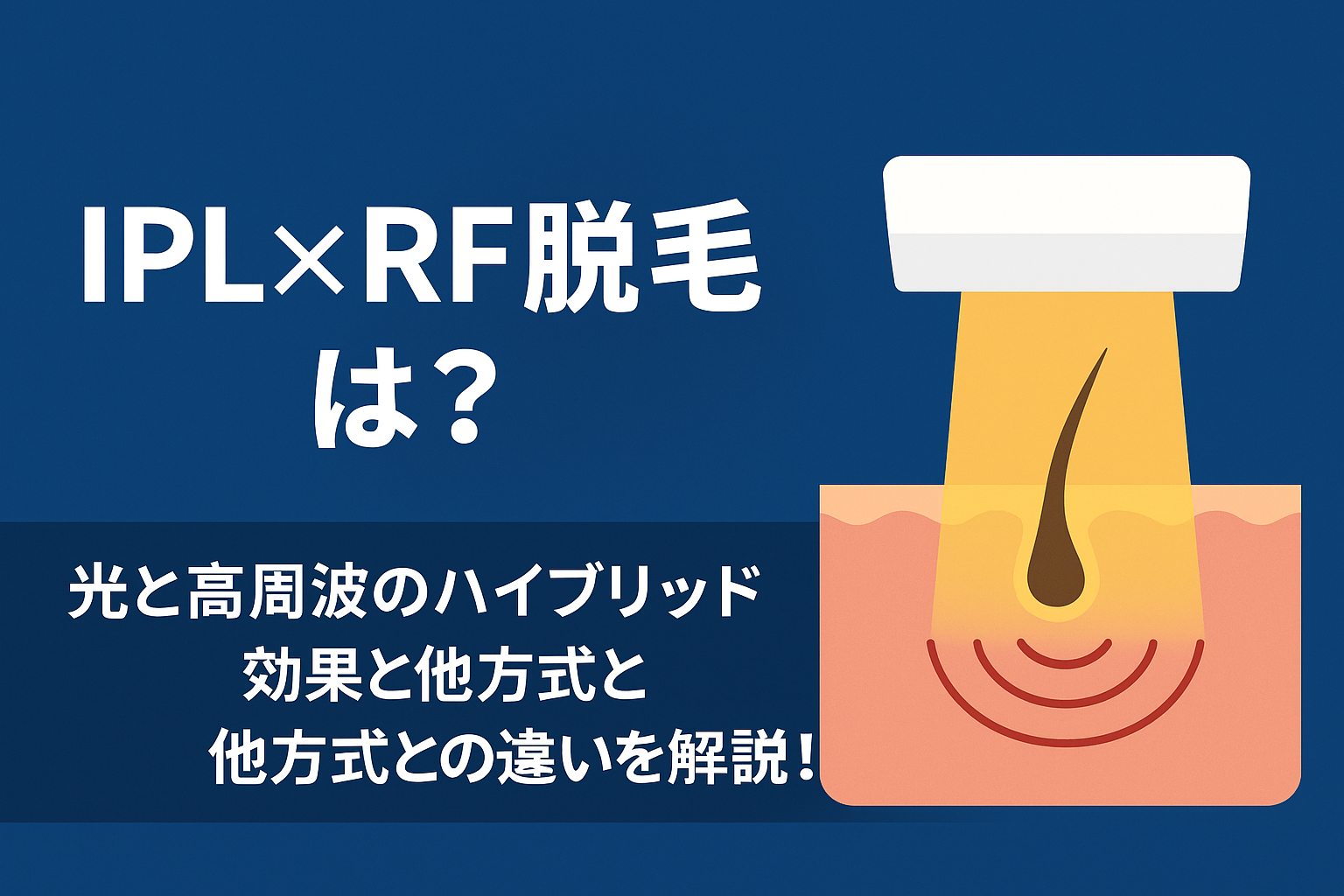 IPL×RF脱毛とは？光と高周波のハイブリッド効果と他方式との違いを解説！