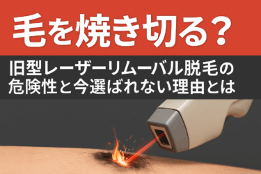 毛を焼き切る？旧型レーザーリムーバル脱毛の危険性と今選ばれない理由とは